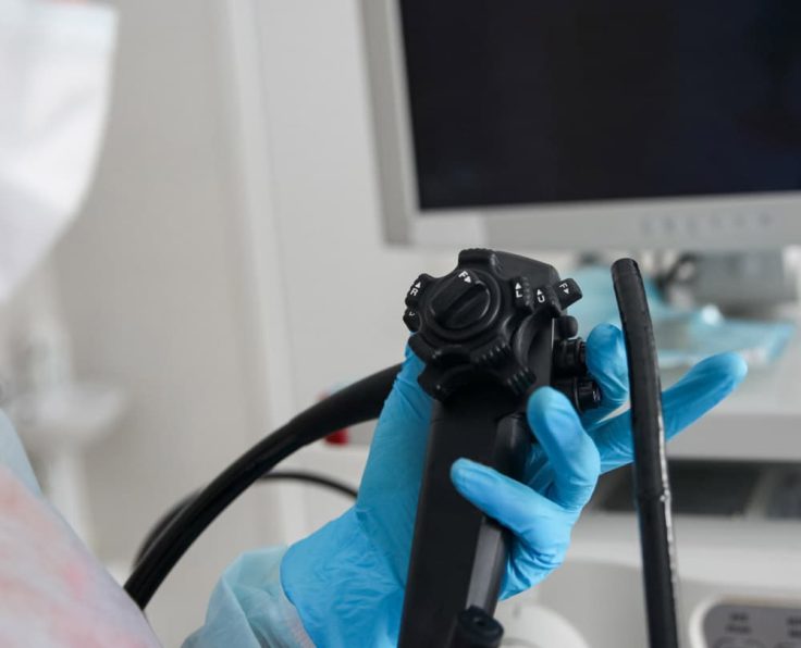 endoscopy endoscopy