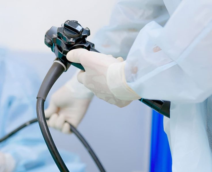 gastroscopy gastroscopy