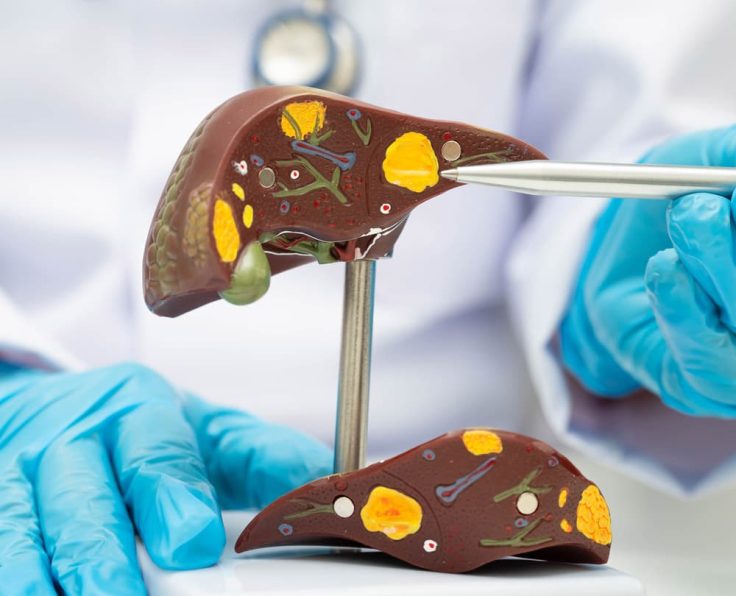 liver-screening liver-screening