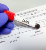 Tumour markers
