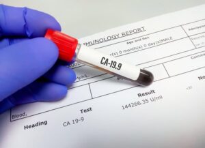 Tumour markers